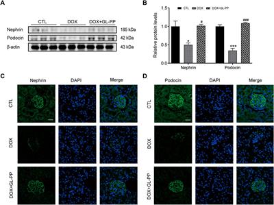 Therapeutic potential of Ganoderma lucidum polysaccharide peptide in Doxorubicin-induced nephropathy: modulation of renin-angiotensin system and proteinuria